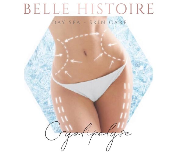 cryolipolyse wellness belle histoire waasland